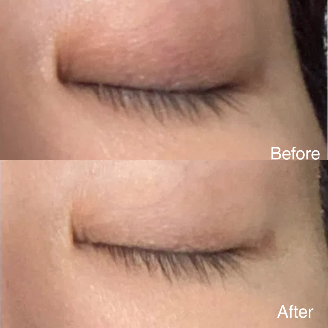 EYES LIFTER - Invigorating Eye Serum