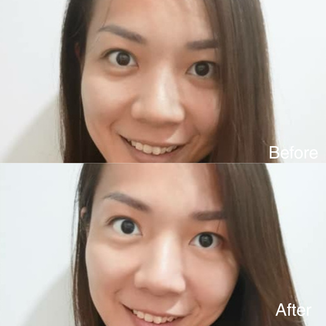 EYES LIFTER - Invigorating Eye Serum