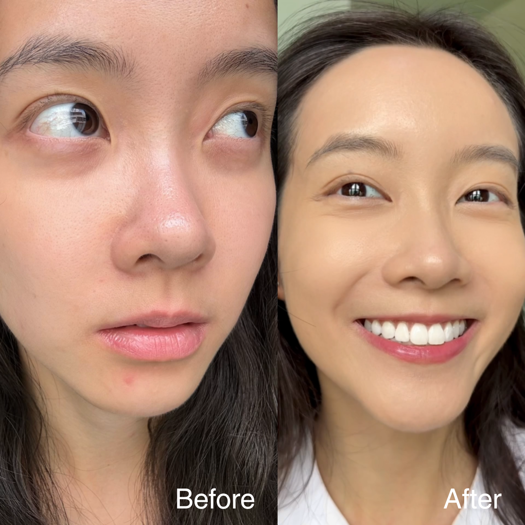 EYES LIFTER - Invigorating Eye Serum