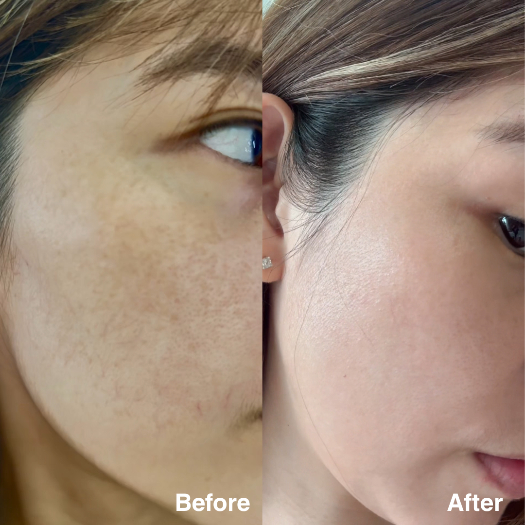 Clarity Corrector - Intensive Dark Spot Treatment