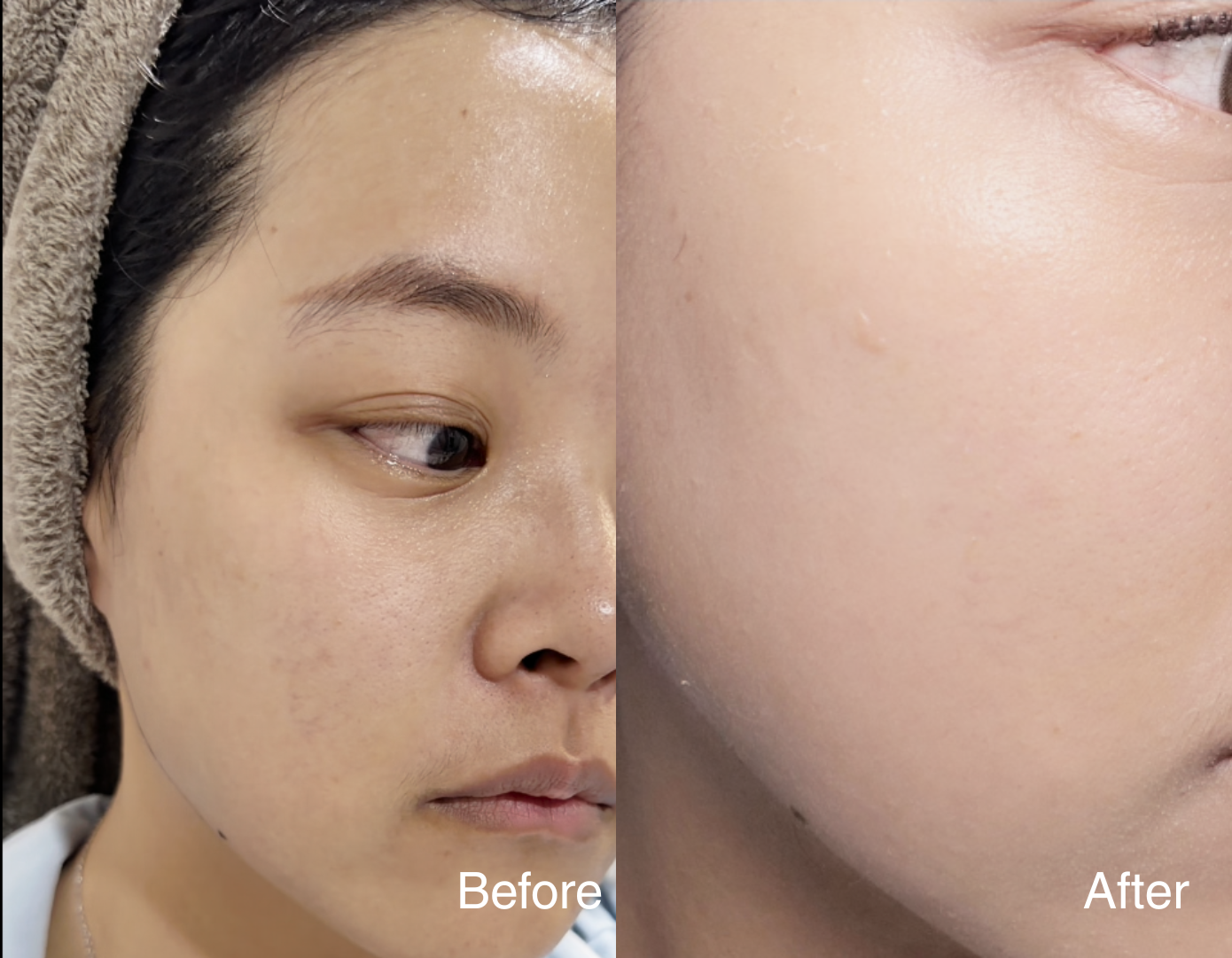 Clarity Corrector - Intensive Dark Spot Treatment