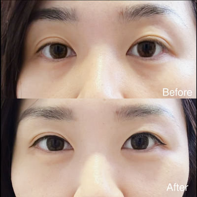 EYES LIFTER - Invigorating Eye Serum