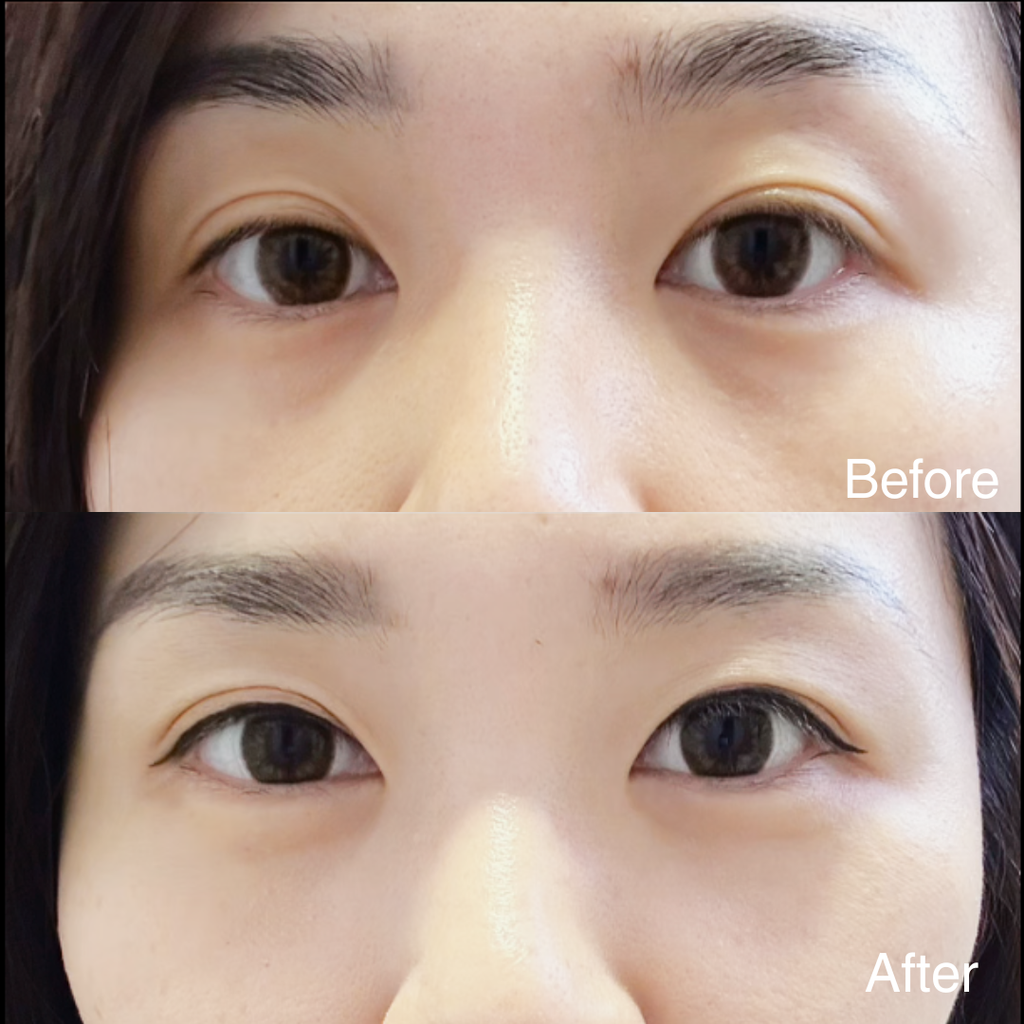 EYES LIFTER - Invigorating Eye Serum