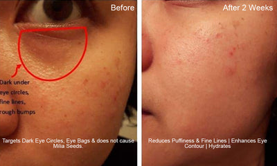 EYES LIFTER - Invigorating Eye Serum(Water-based)