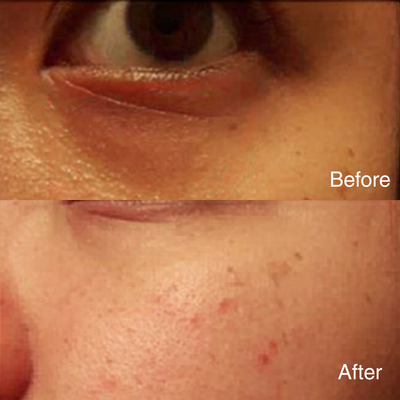 EYES LIFTER - Invigorating Eye Serum