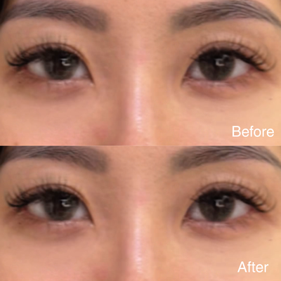 EYES LIFTER - Invigorating Eye Serum