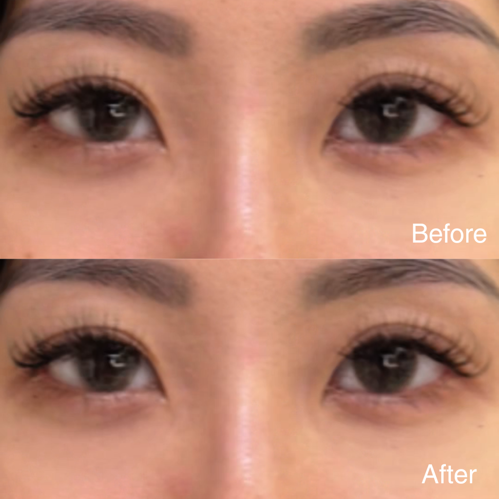 EYES LIFTER - Invigorating Eye Serum