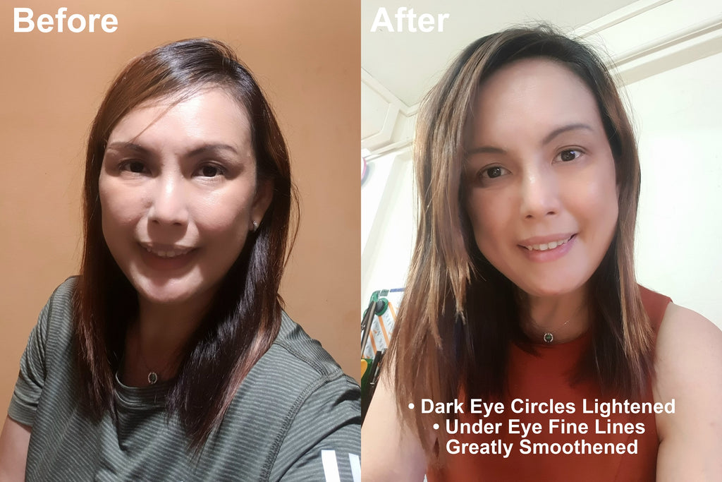 EYES LIFTER -Invigorating Eye Serum (Water-based)