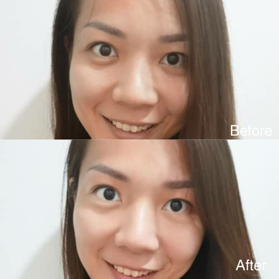 EYES LIFTER - Invigorating Eye Serum