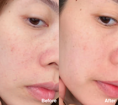 Clarity Corrector - Intensive Dark Spot Treatment