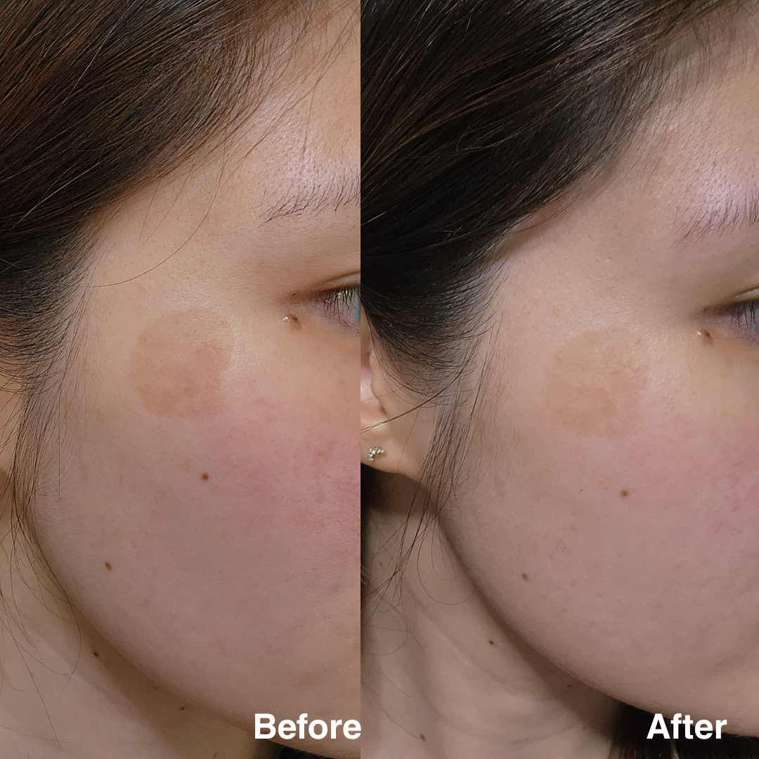 Clarity Corrector - Intensive Dark Spot Treatment