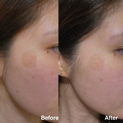 Clarity Corrector - Intensive Dark Spot Treatment