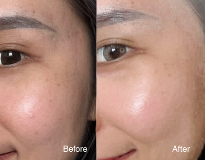Clarity Corrector - Intensive Dark Spot Treatment