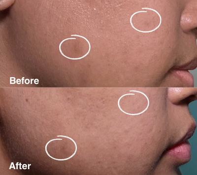Clarity Corrector - Intensive Dark Spot Treatment