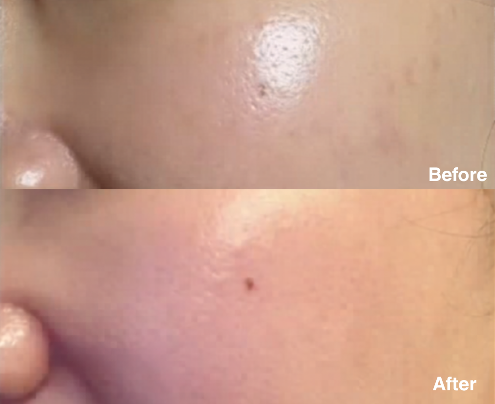 Clarity Corrector - Intensive Dark Spot Treatment