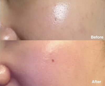 Clarity Corrector - Intensive Dark Spot Treatment
