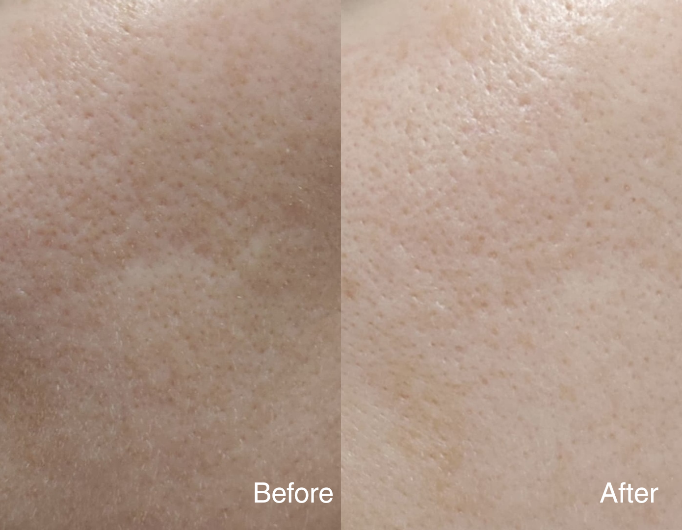 Clarity Corrector - Intensive Dark Spot Treatment