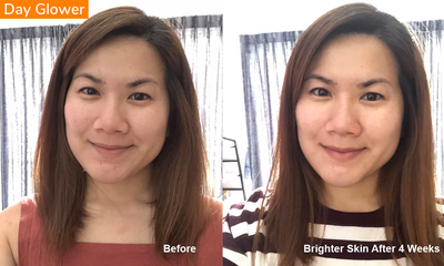 [Limited Edition Bundle] Brightening Essentials Bundle