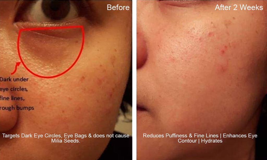 EYES LIFTER - Invigorating Eye Serum (Water-based)