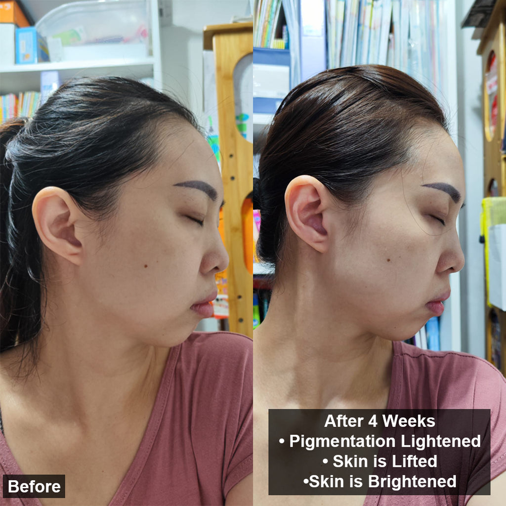 Day Glower & Derma Activator Bundle Set
