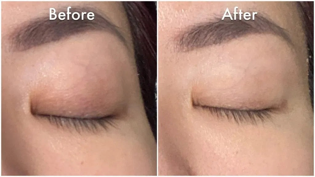 EYES LIFTER - Invigorating Eye Serum (Water-based)